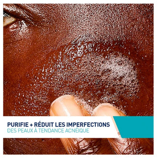 Cerave Acné Gel Moussant Anti-Imperfections 236 ml à l'Acide Salicylique et Aux 3 Céramides Essentiels Pour Peaux à Imperfections et à Tendance Que