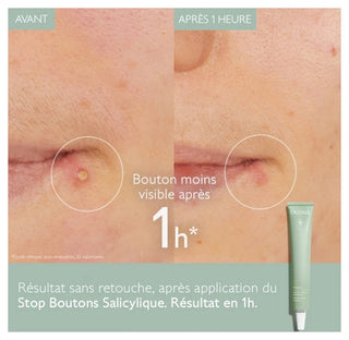 Caudalie Vinopure Stop Boutons Salycilique - 15 ml
