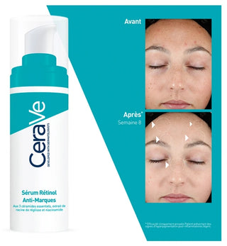 Cerave Acné Sérum Rétinol Anti-Marques 30 ml Enrichi au Rétinol Encapsulé et Aux 3 Céramides Essentiels Pour Peaux à Imperfections Avec Des Marques Post-(Hyperpigmentation Post Inflammatoire ou Pih)
