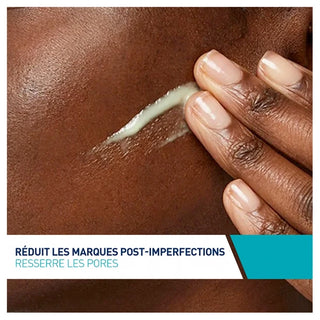 Cerave Acné Sérum Rétinol Anti-Marques 30 ml Enrichi au Rétinol Encapsulé et Aux 3 Céramides Essentiels Pour Peaux à Imperfections Avec Des Marques Post-(Hyperpigmentation Post Inflammatoire ou Pih)