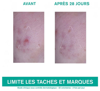 Uriage Hyséac 3-Regul+ Soin Global Anti-Imperfections 40 ml
