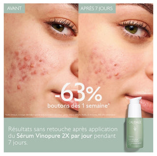 Caudalie Vinopure Sérum Anti-Imperfections 30 ml