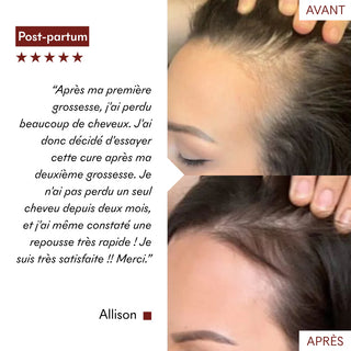 Makemymask Serum Anti chute Tricho-boost 20mL