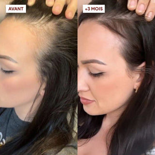 gommage anti-chute cheveux