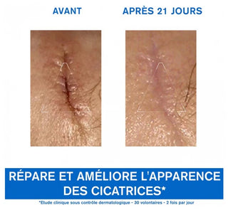 Uriage Bariéderm Cica-Crème Apaisante Réparatrice