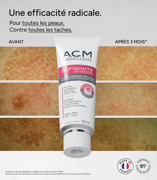 Crème Intensive Anti-Taches