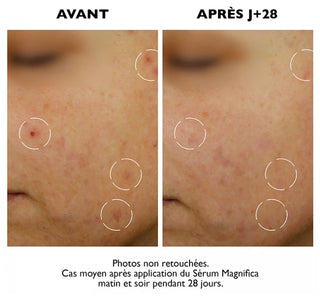 Sanoflore Magnifica Sérum Correcteur Global Anti-Imperfections Certifié Bio 30 ml