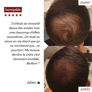 Makemymask Serum Anti chute Tricho-boost 20mL